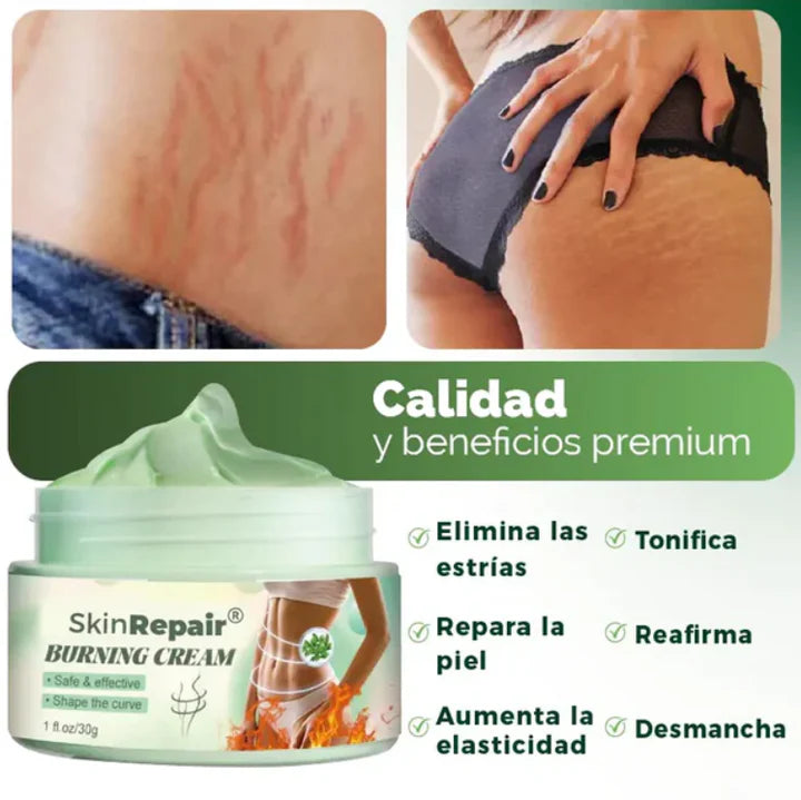 CREMA ANTIESTRÍAS SKINREPAIR ~ 50% DE DESCUENTO [ÚLTIMAS UNIDADES]