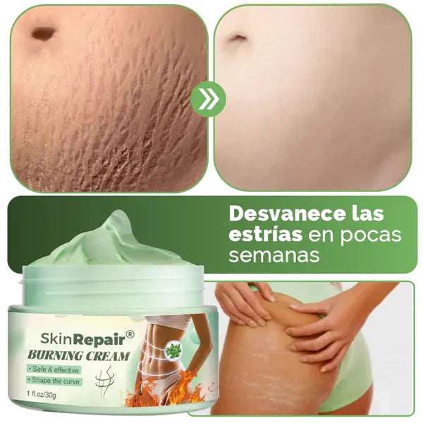 CREMA ANTIESTRÍAS SKINREPAIR ~ 50% DE DESCUENTO [ÚLTIMAS UNIDADES]